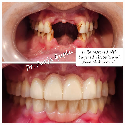 dr pooja dental clinic